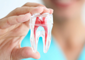 Dịch Vụ Điều Trị Tủy Răng